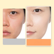 Prima e dopo trattamento viso: pelle liscia e luminosa, riduzione pori e imperfezioni. Cura della pelle, miglioramento carnagione, skincare efficace.