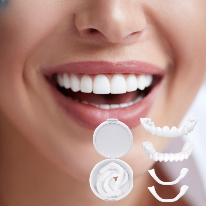 Sorriso luminoso con faccette dentali bianche, kit di faccette estetiche in resina, miglioramento estetico dentale, denti perfetti, sorriso smagliante.