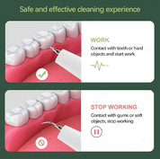 Dentora | Dispositivo professionale per la rimozione del tartaro a ultrasuoni per un'efficace cura dentale a casa 4