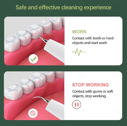 Dentora | Dispositivo professionale per la rimozione del tartaro a ultrasuoni per un'efficace cura dentale a casa 4