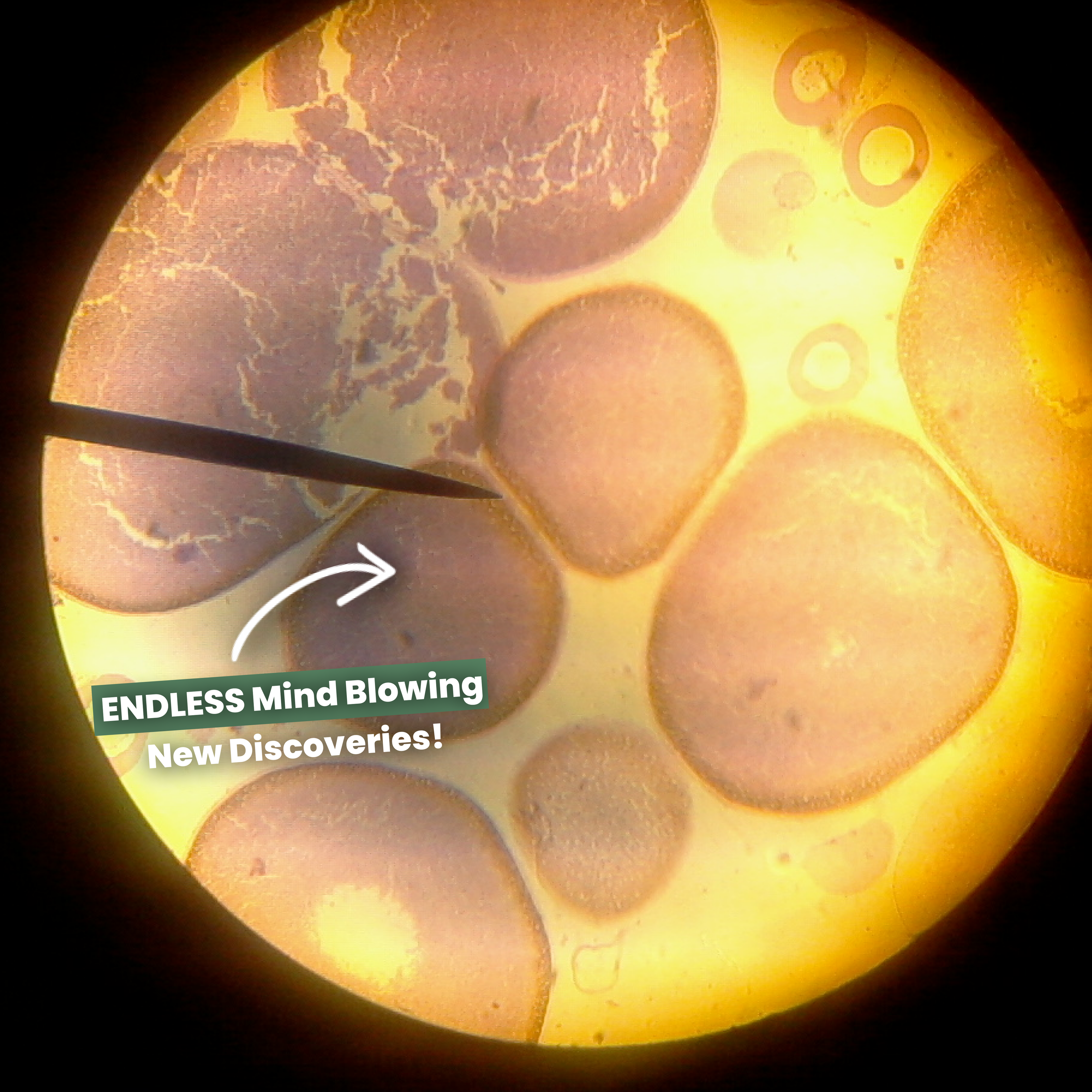 Immagine al microscopio di cellule batteriche tonde, con testo promozionale "ENDLESS Mind Blowing New Discoveries!" in evidenza.