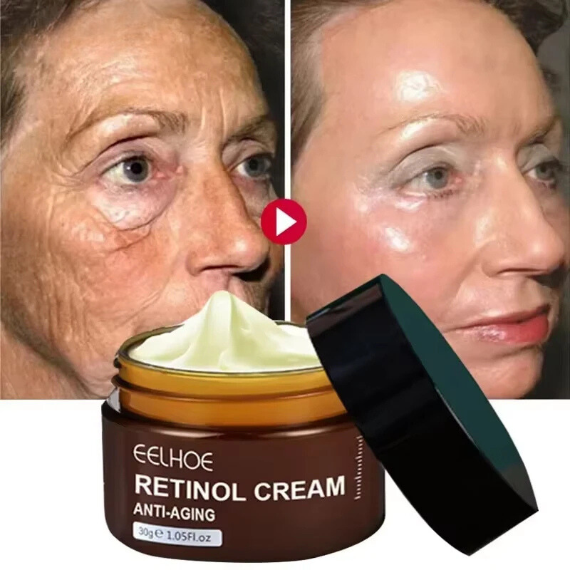Crema al retinolo anti-età Eelhoe, 30g, con risultati visibili su rughe e pelle, prima e dopo l'applicazione, miglioramento della texture cutanea.